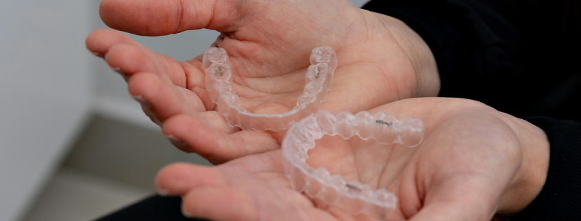 Nošenje retainera kako se zubi nebi pomicali