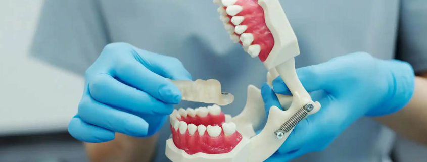 ortodontske terapije