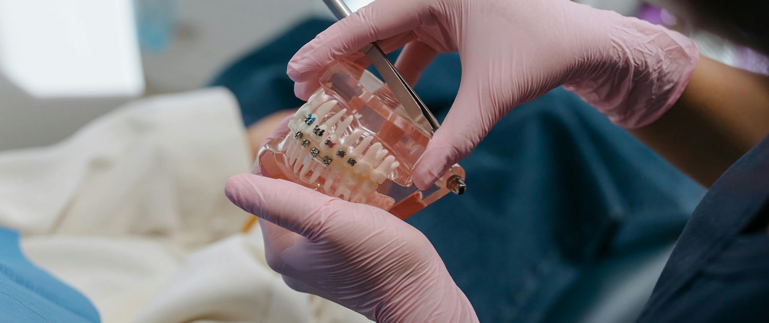 ortodont u rozim gumenim rukavicama drži model zubala sa aparatićem