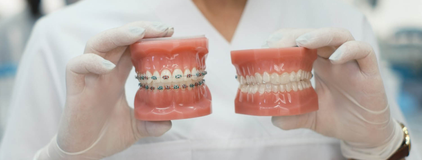 razlika između stomatologa i ortodonta