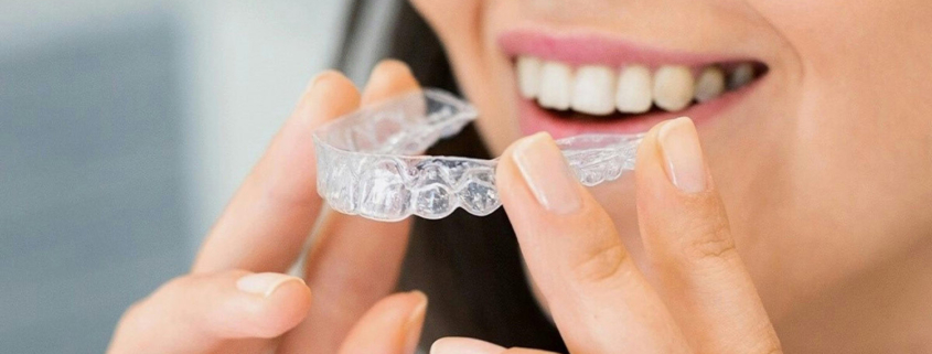 retencija nakon ortodontske terapije