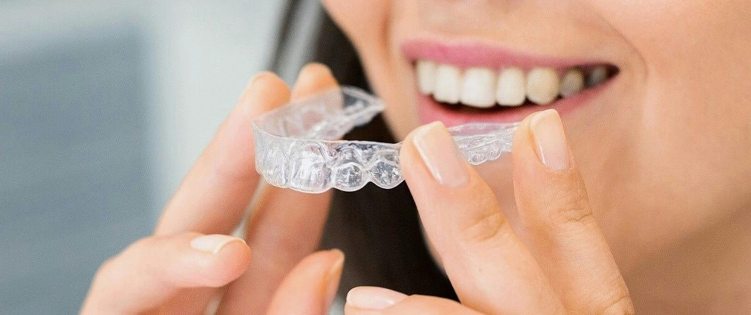 retencija nakon ortodontske terapije