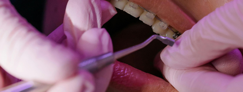 Pregled kod ortodonta