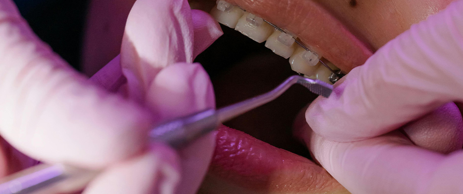 Pregled kod ortodonta