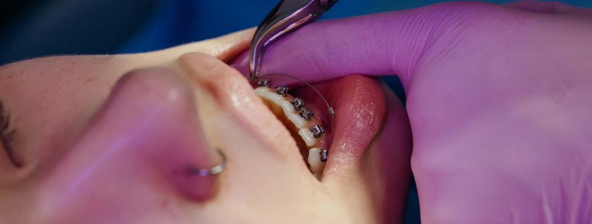 pregled kod ortodonta