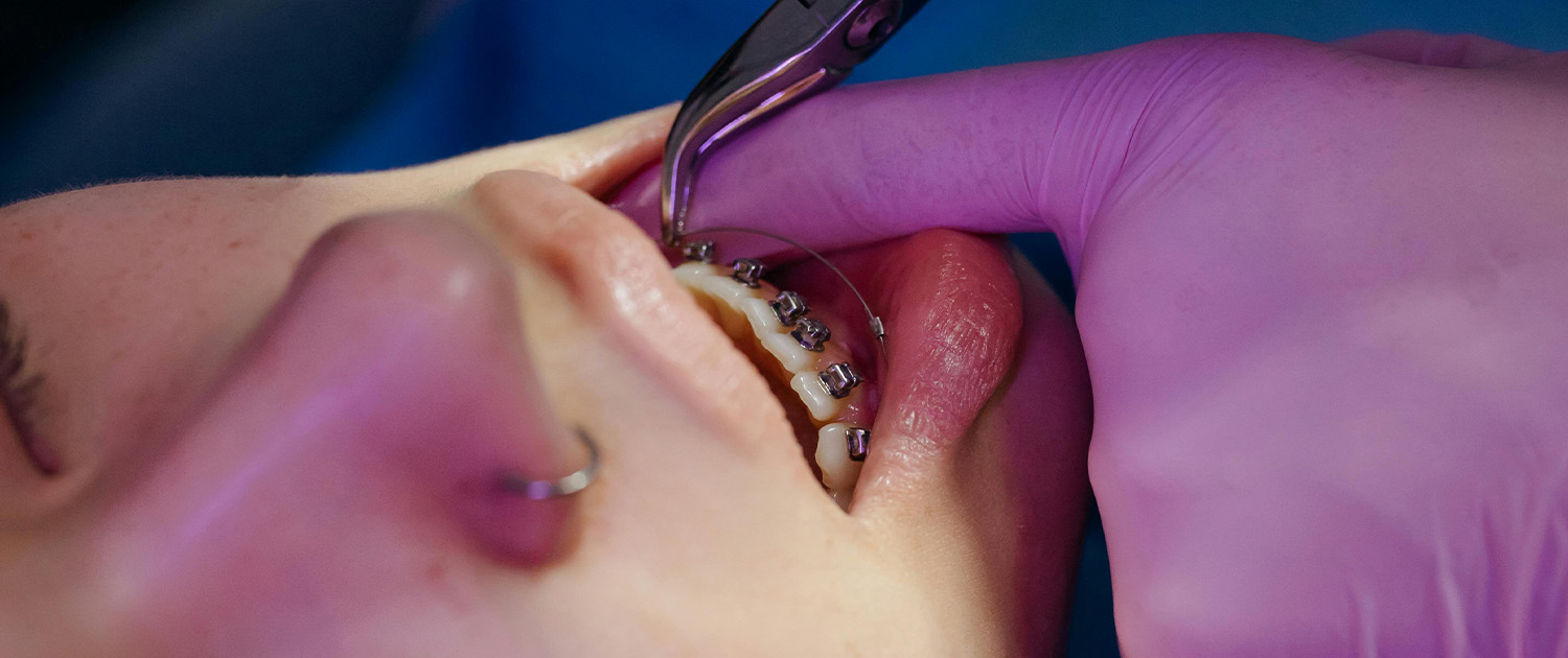 Pregled kod ortodonta