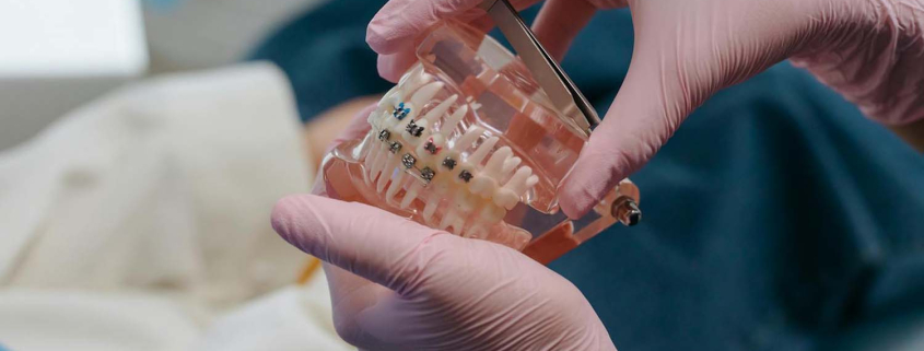 fiksni aparatić zagreb