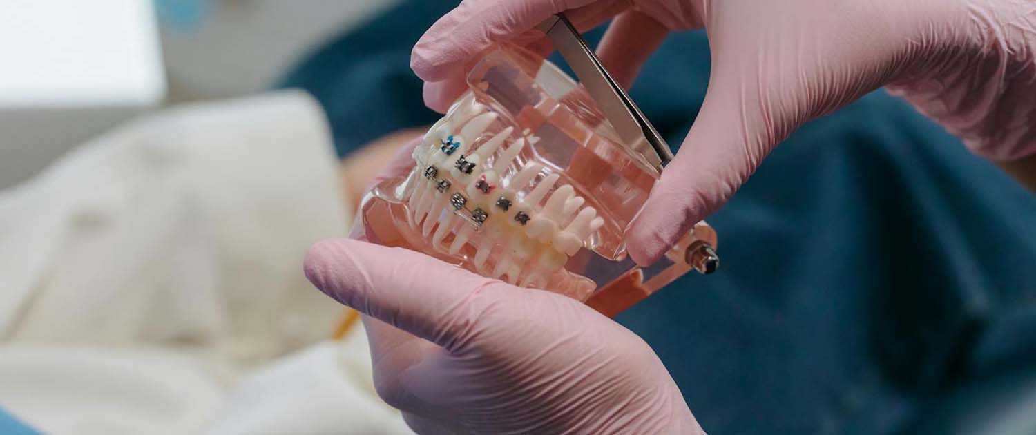 fiksni aparatić zagreb