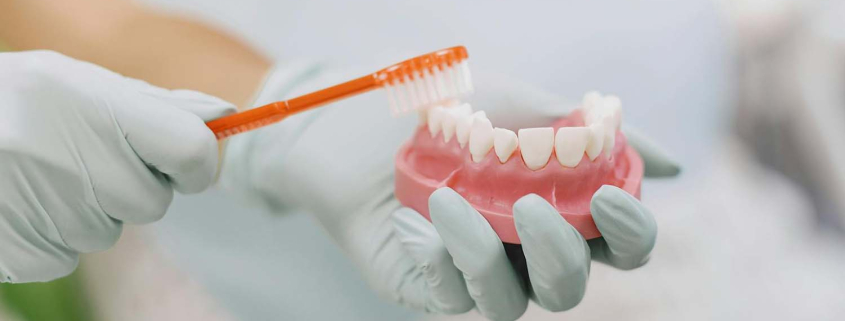 Invisalign aligneri higijena