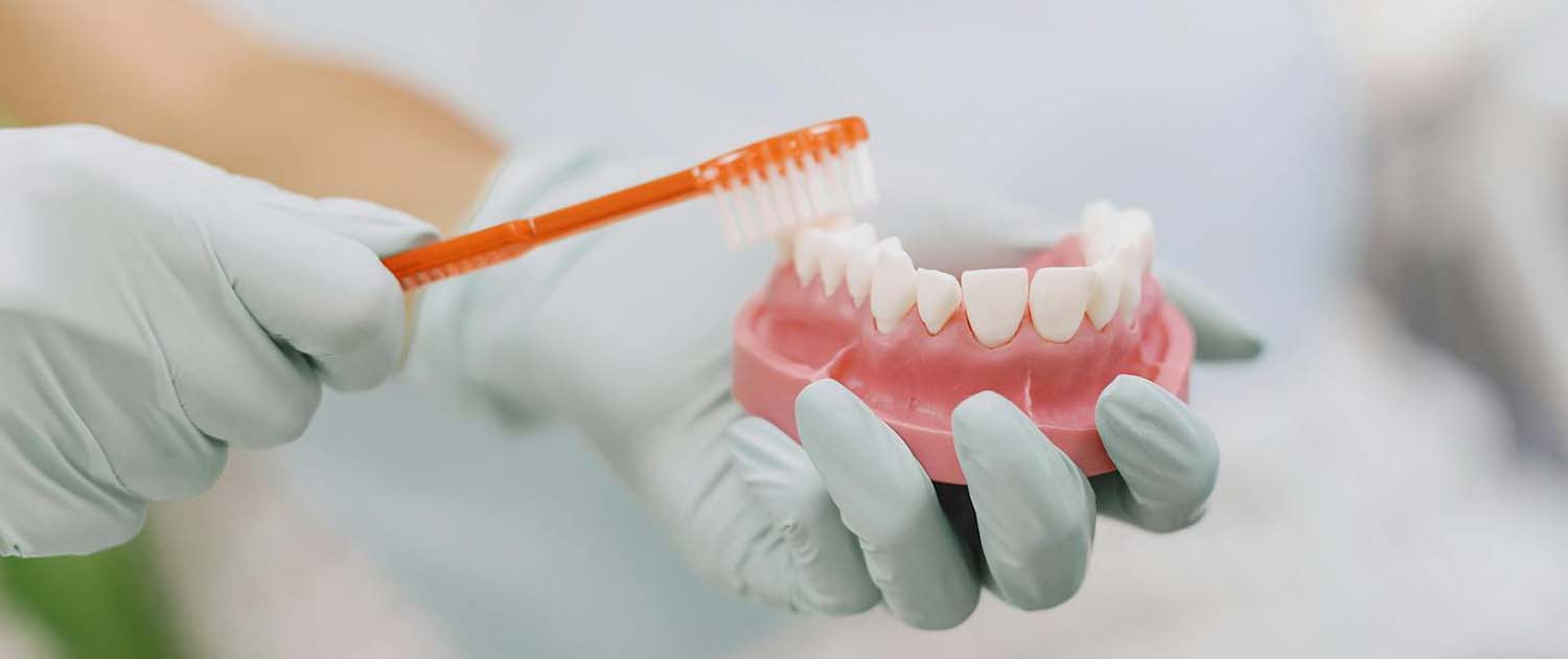 Invisalign aligneri higijena