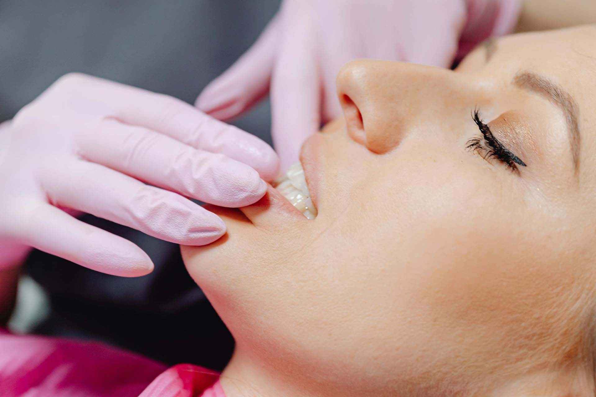 Prozirni aparatić higijena