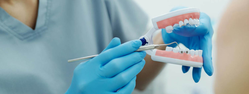 fiksni aparatić zagreb