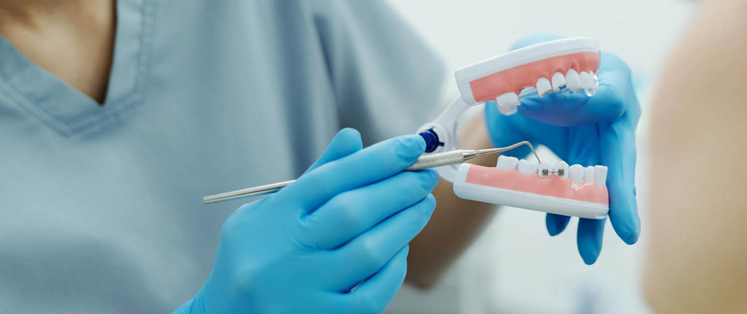 fiksni aparatić zagreb