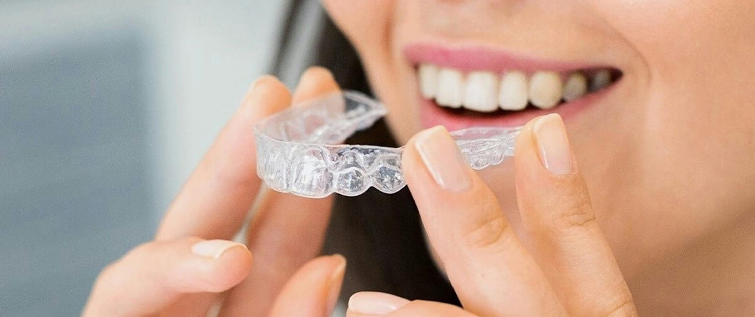 retainer
