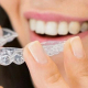 žena stavlja invisalign aparatić za zube