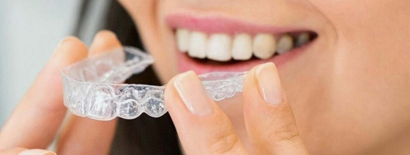 žena stavlja invisalign aparatić za zube