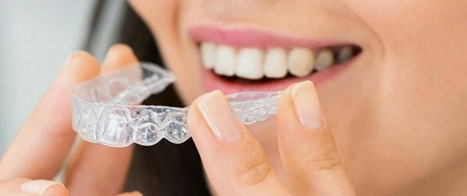 žena stavlja invisalign aparatić za zube