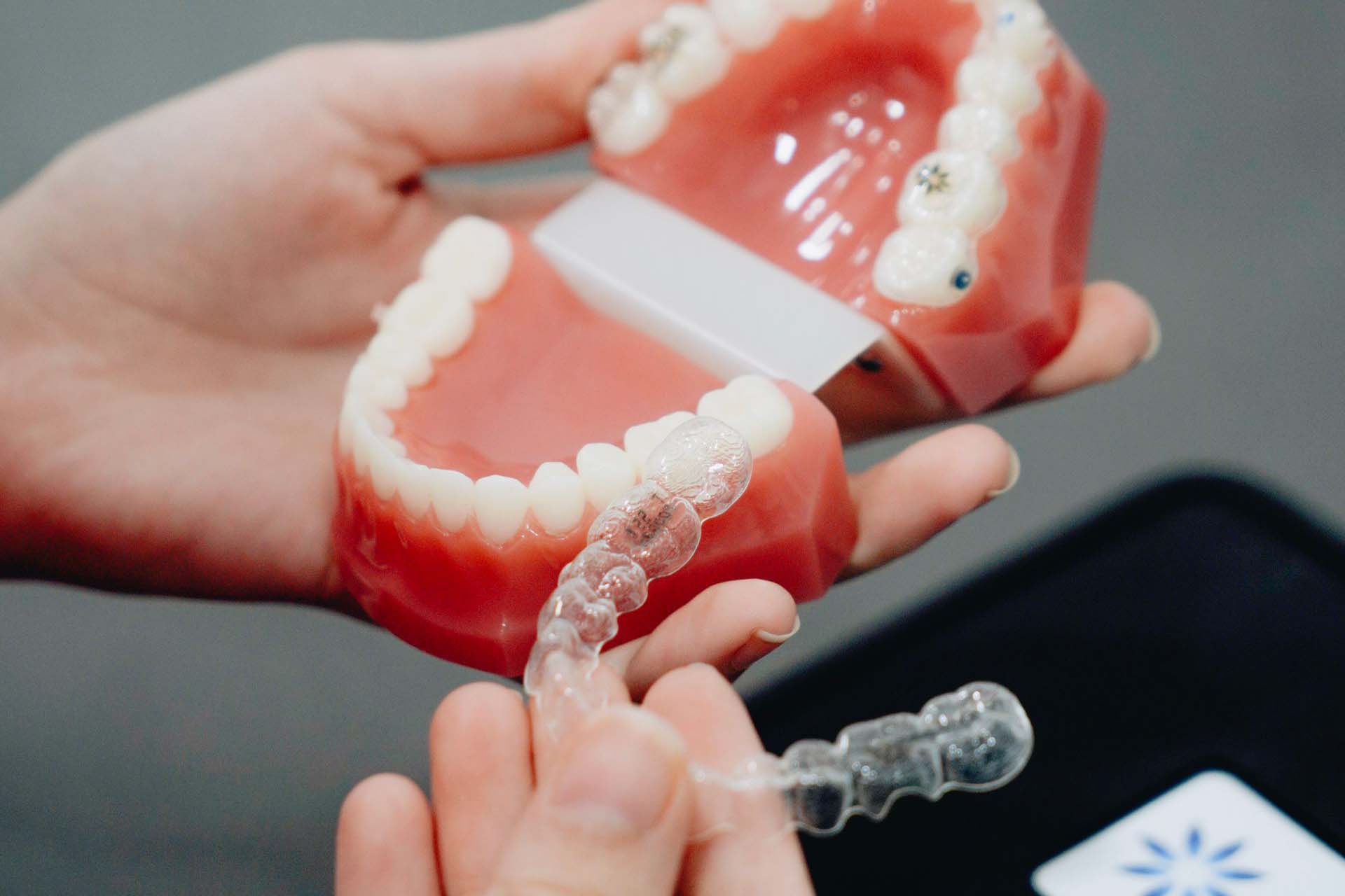invisalign aparatić za zube zagreb
