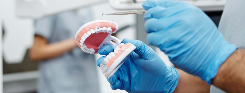 aparatić za zube s krunicama i implantatima
