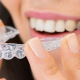 invisalign