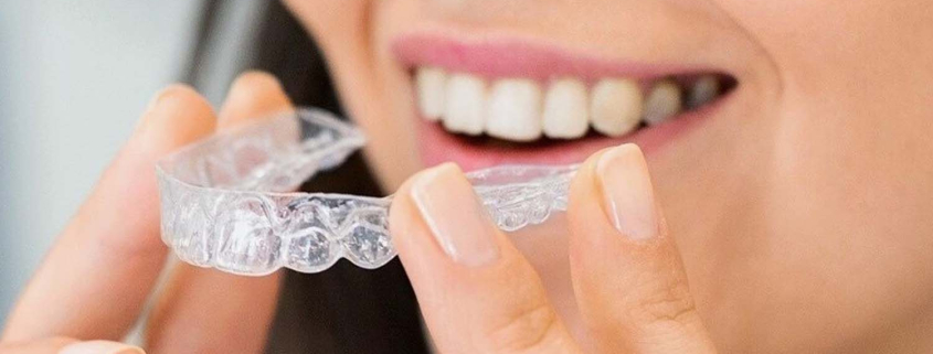 invisalign