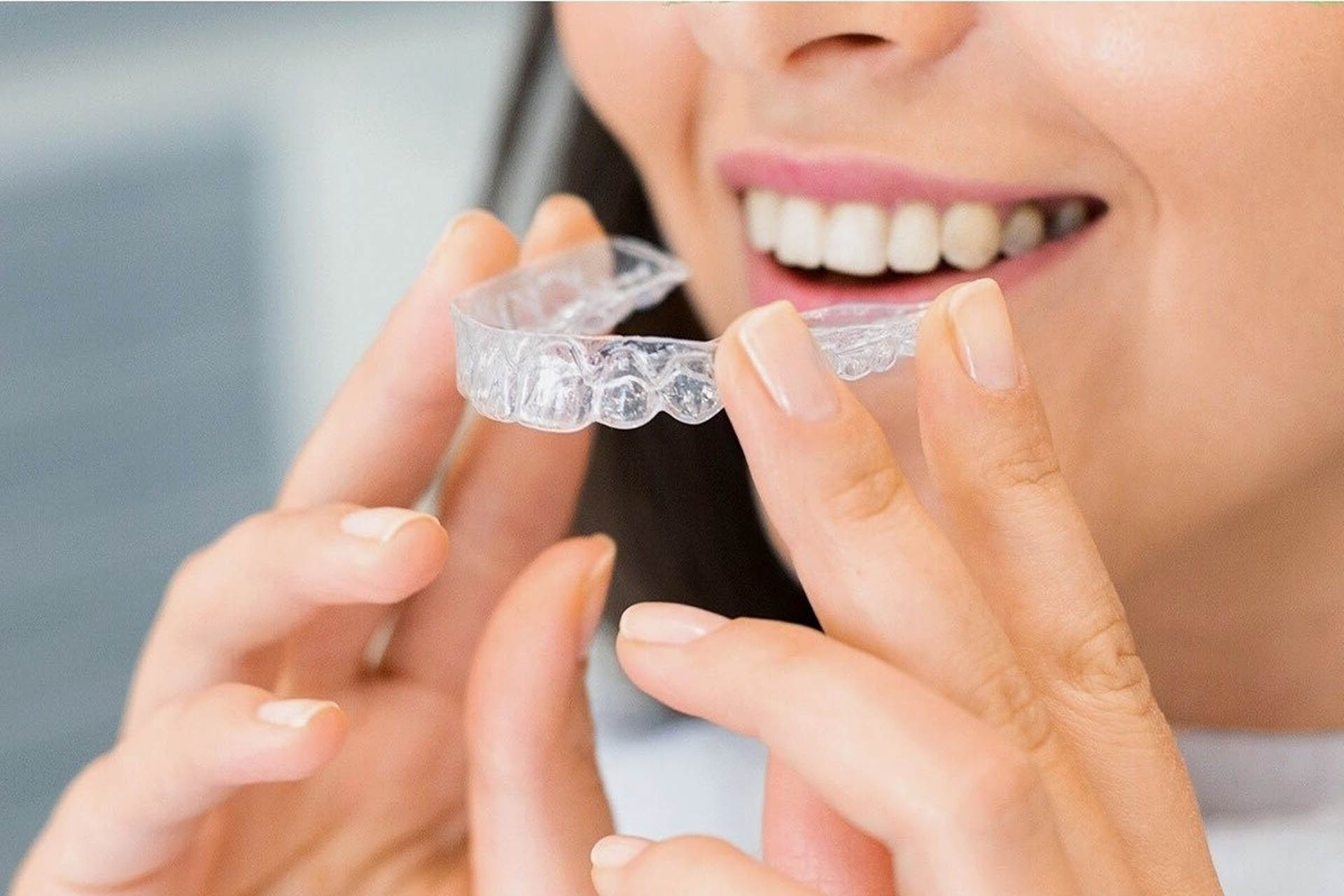 invisalign čišćenje